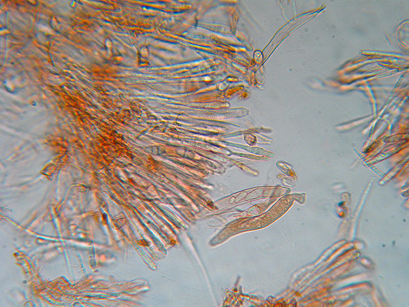 Heterosphaeria patella